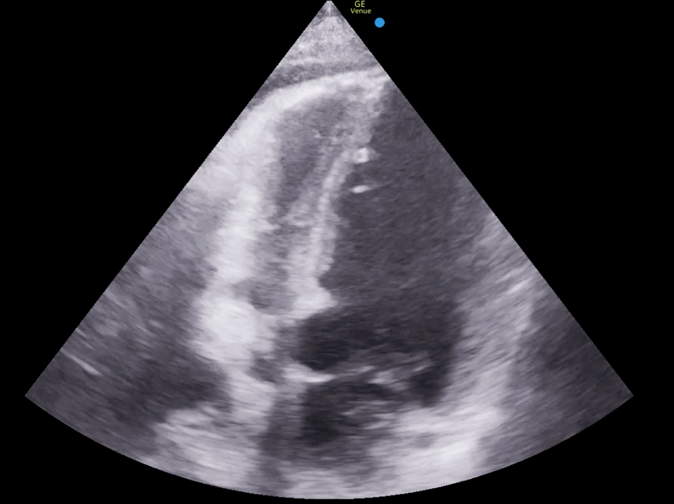 EEU case image missing